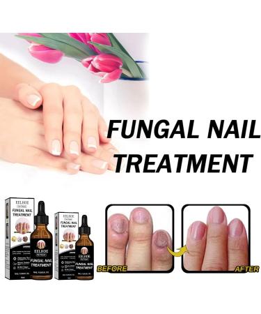 CAOQAO Nail Fix Solution Thickened Bright Nails To Get Rid Of Nail Dead Skin Fix Moisturizing Nail Nutrition Care Solution 30ml Nail Suction (B One Size) 1 count (Pack of 1) B - Buy Online on GoSupps.com