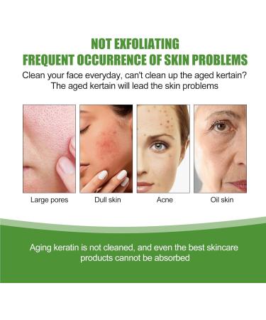 Aloe Exfoliating Moisturizing Gel Aloe Vera Deep Cleansing Exfoliating Peeling Gel Aloe Facial Scrub Natural Exfoliating Facial Scrub Aloe Vera Face Exfoliator Gel Aloe Vera Exfoliating Face Scrub - Buy Online on GoSupps.com