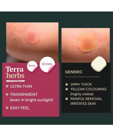 72 Hydrocolloid Pimple Patches for Face - Gentle Acne Treatment Stickers for Blemish Cover - Invisible Dots for Spots - Long Lasting Skincare Solution - Buy Online on GoSupps.com