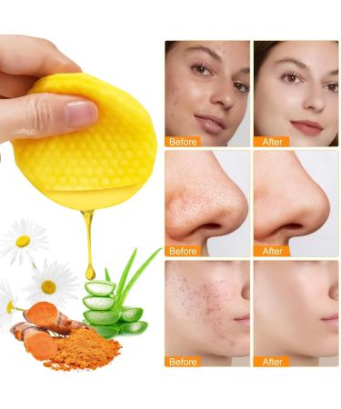 Turmeric Kojic Cleansing Pads - 60 Pack | Natural Face & Body Cleansing for Balanced Skin - Buy Online on GoSupps.com