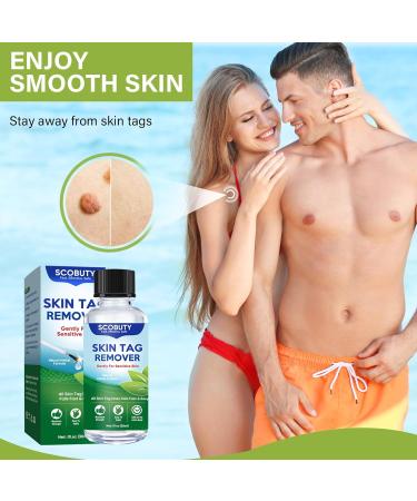 Skin Tag Removal Remover Kit Wart and Mole Remover Verruca Treatment for Hands Face Adults at Home 30ML - Buy Online on GoSupps.com