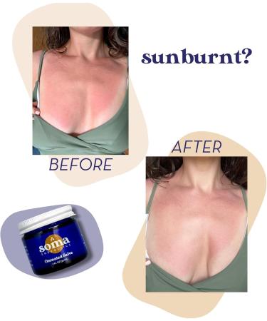 Ozonated Organic Salve for Skin Repair | Joint Pain Relief & Eczema Treatment | 2 oz Natural Healing Balm - Buy Online on GoSupps.com