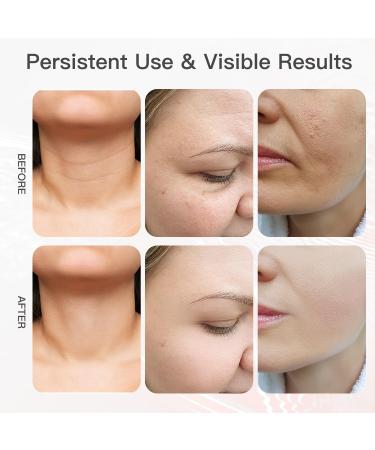 Neck Face Massager 3 Color Modes & Vibration Facial Sculpting Tool for Double Chin & Skin Care (White) International Shipping Available - Buy Online on GoSupps.com