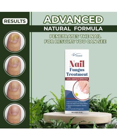 Extra Strength Toenail Fungus Treatment - Nail Repair for Cracked & Damaged Nails - Cure for Thick, Yellow, Discolored Nails - Buy Online on GoSupps.com