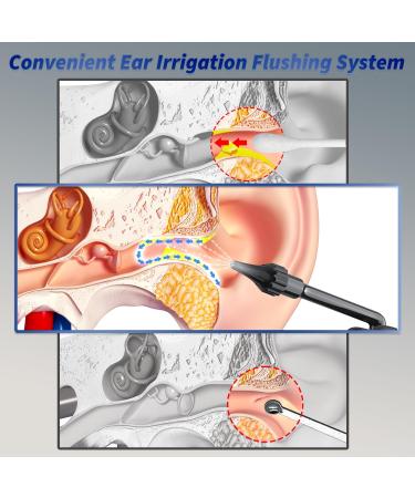 Electric Ear Wax Removal Tool - Water Powered Ear Cleaner with 4 Modes | Safe & Effective | USB Rechargeable - International Shipping Available - Buy Online on GoSupps.com