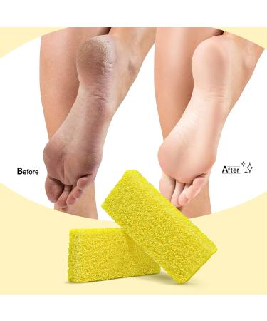 40Pcs Yellow Medium Coarse Disposable Foot Scrubber Sponge Pads - Pedicure Pumice Stone for Feet Callus Remover - Buy Online on GoSupps.com