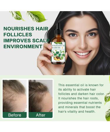 Natural Polygonum Multiflorum Hair Essential Oil | Nourish Scalp Strengthen Roots & Promote Hair Growth for Men & Women - Buy Online on GoSupps.com
