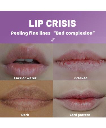  Ziennhu Skin Food Lip Balm - Intensely Repairs and Nourishes Dry and Chapped Lips - Protects Against Dryness Milano Lip Balm | Intensive Nourishing Lip Balm Cica Serum Stick - Buy Online on GoSupps.com