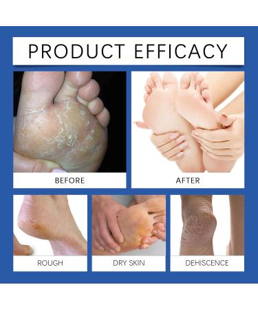  Alelyer Moisturizing and anti-crack foot cream 60% urea foot cream Moisturizing foot cream Repairing cream for cracked heels Foot care balm cream Cream for - Buy Online on GoSupps.com