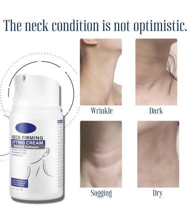 Tighten and Lift Neck Cream - Neck Firming Cream with Retinol and Collagen - Neck Cream Rich in Hyaluronic Acid and Vitamin B5+E - Tightening Lifting Sagging Skin Neck Moisturizer 50ml - Buy Online on GoSupps.com