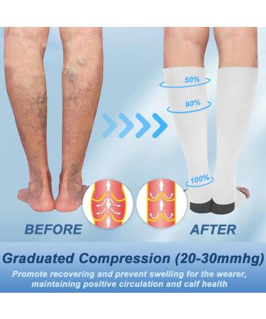 Buy Knee High Medical Compression Socks 20-30 mmHg for Men & Women - Open Toe Support for Varicose Veins DVT Edema - XX-Large White & Gray - Buy Online on GoSupps.com