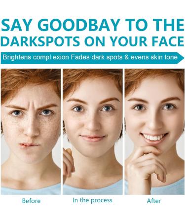 Dark Spot Cream for Face Body Dark Spot Remover Dark Spot Corrector Cream Moisturizes Armpit Neck Knees and Private Parts for All Skin Types - Buy Online on GoSupps.com