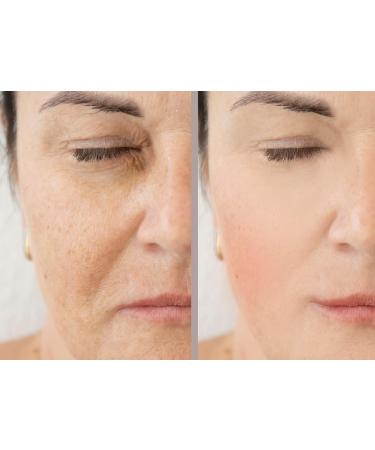 Buy Vitality Precision Skin Phloretin C Serum | Best Anti-Aging Formula for Radiant Skin - International Shipping Available - Buy Online on GoSupps.com