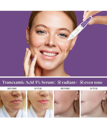 THESKCARE 5% Tranexamic Acid Serum Ampoule for Face with Niacinamide Kojic Acid & Alpha Arbutin Skin Glowing Serum for Dark Spots Even Out Skin Tone 30 Ampoules - Buy Online on GoSupps.com