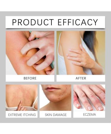 ERMOPATRY Organic Chickweed Salve 4oz - Chickweed Herbal Ointment Salve Cream Skin Soothing Balm (1pcs) - Buy Online on GoSupps.com