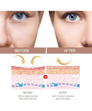 Anti Wrinkle Eye Cream Stick Eye Cream For Dark Circles And Puffy Eyes Anti Wrinkle Eye Balm Stick Moisture Glow Multi Balm Stick Collagen Eye Cream Anti Aging Under Eye Cream For Women/Men - Buy Online on GoSupps.com