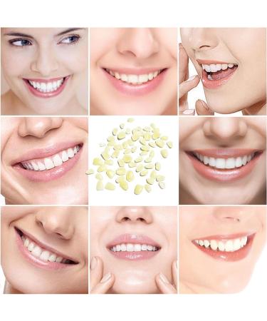 Tooth Repair Kit - Thermal Fitting Beads & Granules for Quick Fix of Missing & Broken Teeth - Easy Temporary Solution for Men & Women (Natural Yellow - Buy Online on GoSupps.com