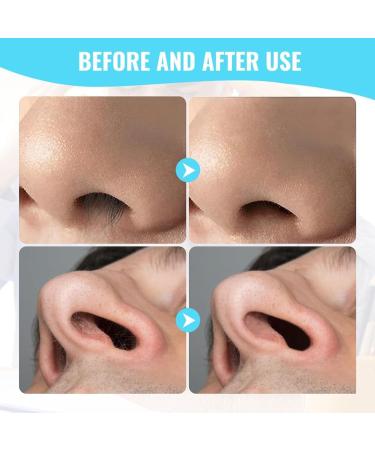 Upgraded Double-Sided Nose Hair Cutter Trimmer - 360 Rotating Manual Tool for Men & Women - 9PCS Pink Nose & Ear Hair Remover - Buy Online on GoSupps.com