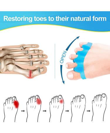 8 PCS Juzure Silicone Toe Separators for Bunions - Toe Correctors for Women & Men - Buy Online on GoSupps.com