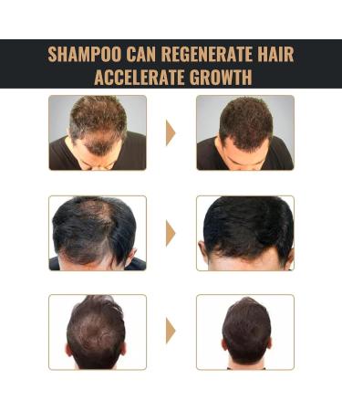 Revitalizing Root Shampoo Anti-Hair Loss Shampoo Thick Hair Shampoo Strong Repair Shampoo Unisex - Buy Online on GoSupps.com