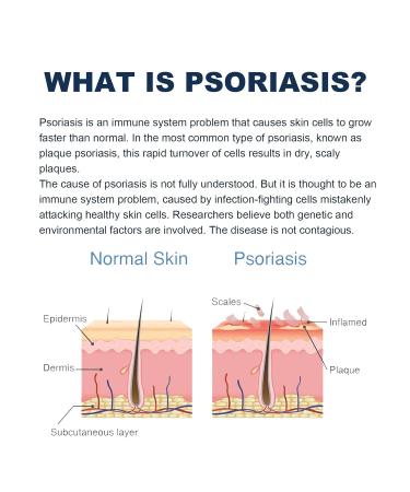 Skin Smart Eczema Therapy Spray by Dermeleve - Steroid-Free Itch Relief Cream (1PC) - Buy Online on GoSupps.com