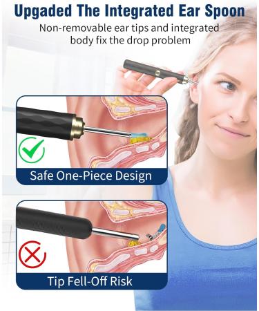 Kekoy Ear Wax Removal Kit - 1296P HD WiFi Otoscope Ear Camera for Adults & Kids - Rechargeable Ear Cleaner Tool with Lights - Black Gold - Buy Online on GoSupps.com