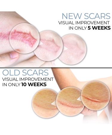 Scarbandit Silicone Scar Sheets - Scars Removal Treatment - Tummy Tuck & C-Section Recovery - 1.57x59 Inch (Pack of 1) - Buy Online on GoSupps.com