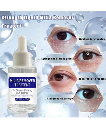 Dermfree Milia Remover Treatment Milia Spot Treatment with Salicylic Acid Milia Acne Serum Clearing Skin Essence(30ML) - Buy Online on GoSupps.com