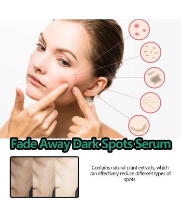  WJnflQN clat du Visage - Skin Care Solution 30ml Anti-Bleaching - Lightening Liquid Facial Spots | Day And Night Care For Women - Buy Online on GoSupps.com