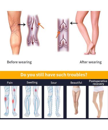 Haodasi Class 2 Medical Compression Pantyhose - Graduated Support Hosiery for Varicose Veins - Women's Beige Compression Stockings - Buy Online on GoSupps.com