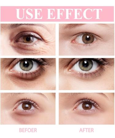 Retinol Eye Cream Retinol Eye Stick for Dark Circles Reduces Fine Lines and Dark Circles Under Eye Cream Eye Balm Stick for Women Reduces Wrinkles Saggy Skin Puffy Eyes Eye Cream for Puffiness - Buy Online on GoSupps.com