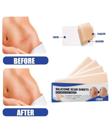 Pore Filler Silicone Gel Scar Patch | Fades Stretch Marks, Burn Scars, Smooth Skin | Cut & Eye Wrinkles Fix Patch | One Size B - Buy Online on GoSupps.com