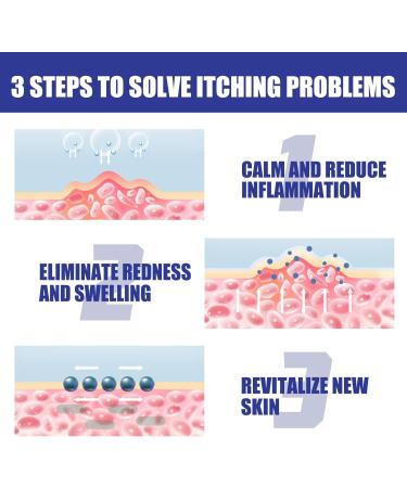 South Moon Kolmax Psoriasis Repair Spray - Professional Treatment for Plaque Psoriasis (3PCS) - Buy Online on GoSupps.com