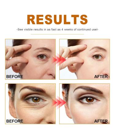 ARCHIDATE Collagen Boost Anti-Aging Serum 2Pcs Deep Collagen Peptide Anti Wrinkle Serum with Hyaluronic Acid Reduces Wrinkles & Fine Lines Lift and Tighten Sagging Skin to Restore Skin Elasticity - Buy Online on GoSupps.com