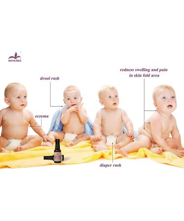 Natural Eczema & Urticaria Treatment Diaper Rash Cream for Babies - Mingmei Herbal Formula 1.5oz - Buy Online on GoSupps.com