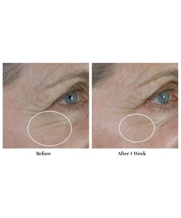 City Beauty Blue Defense HydroGel - Hydrating Face Moisturizer with Hyaluronic Acid for Dark Spots & Wrinkles - Cruelty-Free Anti-Aging Skin Care Solution - Buy Online on GoSupps.com