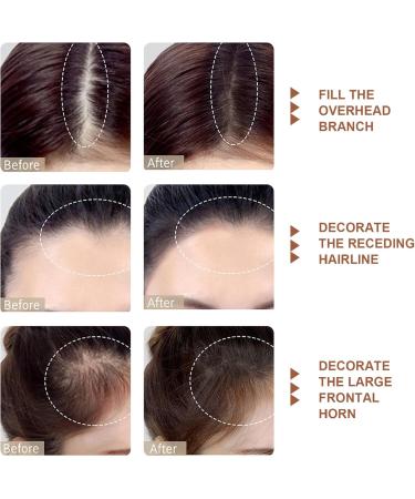 2Pcs Root Touch Up Powder Windproof & Sweatproof Hairline Powder for Women & Wen Natural Stain-Proof Hair Loss Concealer Hairline Powder for Thinning Hairline Light Brown & Brown Light Brown Brown - Buy Online on GoSupps.com