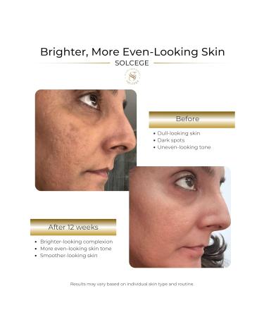 SOLCEGE Dark Spot Corrector & Hyperpigmentation Treatment Cream for Face Uneven Skin Tone Repair with Intense Hydration Alpha Arbutin Kojic Acid & Vitamin C For Men & Women 2 oz - Buy Online on GoSupps.com