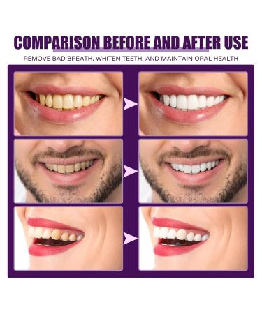 Concentrated Mouthwash for Bad Breath & Yellow Teeth - Clean & Fresh 59ml | Stubborn Tooth Discoloration Remover - Buy Online on GoSupps.com