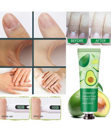 18 Pack Hand Cream Gift Set - Moisturizing Lotion for Dry, Cracked Hands - Travel Size Bulk Hand Lotion for Women, Mom, Girls, Wife, Grandma - Buy Online on GoSupps.com