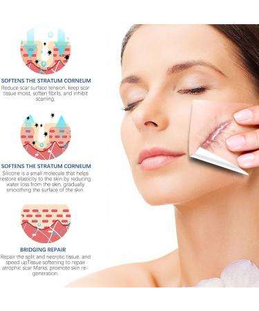 Medical Grade Silicone Scar Sheets (1.6 x130 - 3.3M) for Painless Scar Removal - Surgical Incisions, C-Section, Burn, Keloid, Acne - Silicone Strips Tape Roll - Buy Online on GoSupps.com