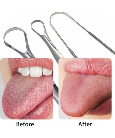 Jaimela Tongue Cleaner Set - 3 Stainless Steel Tongue Scrapers for Superior Oral Hygiene | Metal Tongue Brush with Handle - Buy Online on GoSupps.com