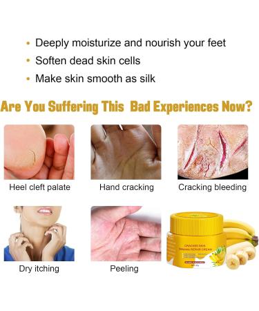 Cracked Heel Repair Foot Cream Cracking Cream Chapping Cream Winter Banana Anti-Cracking Frost Anti-Cracking Frost Feet Moisturizer Skin Repair Cream Anti-Drying Crack Cream - Buy Online on GoSupps.com