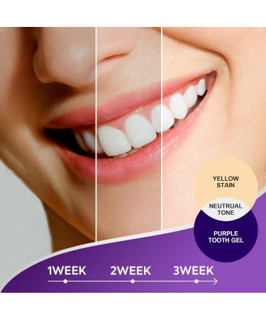 Purple Toothpaste for Teeth Whitening - Effective Stain Remover 50ML - Brighten Your Smile - Buy Online on GoSupps.com