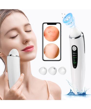EXEMPT Blackhead Remover Vacuum with Camera  Visible Pore Vacuum  Pimple Popper Tool Kit  Facial Comedone Acne Whitehead Extractor Cleaner  Skin Care  Black Head Suction Tool for Women Men