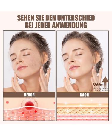 EONFAVE Rindertalg Skin Care Organic Tallow Face Cream GrassFed Beef Tallow Cream with Honey and Beeswax Deeply Caring for Dry Skin on Face & Body Fast Absorption & Not - Buy Online on GoSupps.com