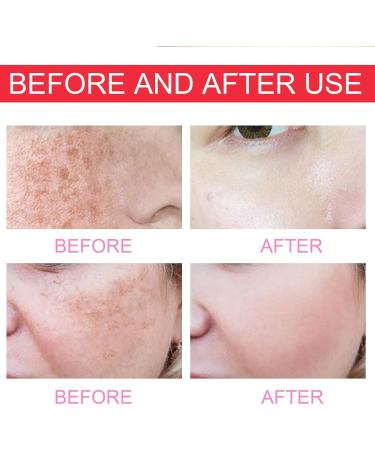 Brightening Clearing Serum Dark Spot Lightening Lotion Faded Serum for Dark Spots Faded Serum Faded Serum For Scars And Dark Spots Effectively Lighten Melanin Deposits and Skin Tone - Buy Online on GoSupps.com