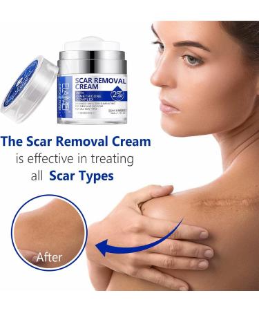 Uocasi Scar Removal Cream Scar Remover Treatment Butter Skin Repair Cream for New and Old Scars Effectively Repairs Facial Skin Cuts Stretch Marks Surgical Scars 50ML - Buy Online on GoSupps.com