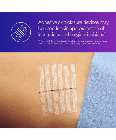3M Steri-Strip R1546 Adhesive Skin Closures 1/4 x 4 - 10 Strips/Envelope - Buy Online on GoSupps.com