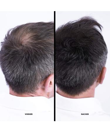 Super Million Hair Fibers - High-Quality Light Gray Hair Thickening - 15g | International Shipping Available - Buy Online on GoSupps.com
